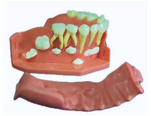 牙列发育模型