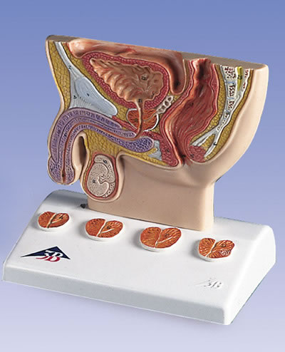 前列腺模型 实物1/2